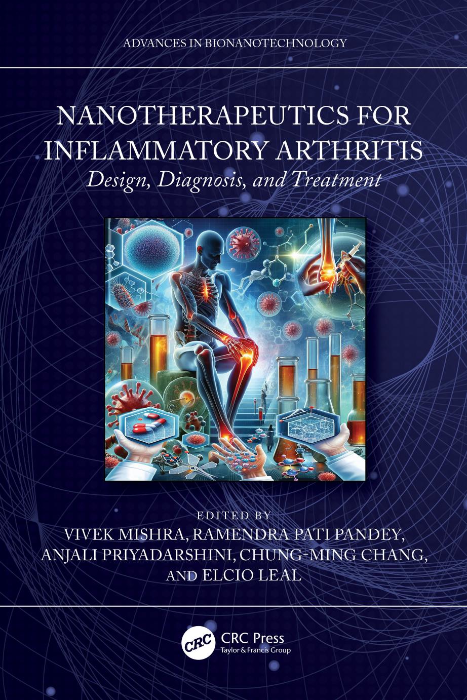 Nanotherapeutics For Inflammatory Arthritis Design Diagnosis And Treatment 1st Edition
