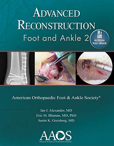 Advanced Reconstruction Foot And Ankle 2 Second Edition Second Ian J Alexander