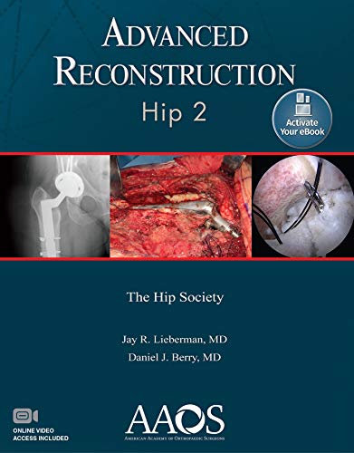 Advanced Reconstruction Hip 2 Aaos American Academy Of Orthopaedic Surgeons 2nd Edition 2nd Jay R Lieberman