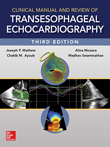 Clinical Manual And Review Of Transesophageal Echocardiography 3rd Edition 3rd Madhav Swaminathan