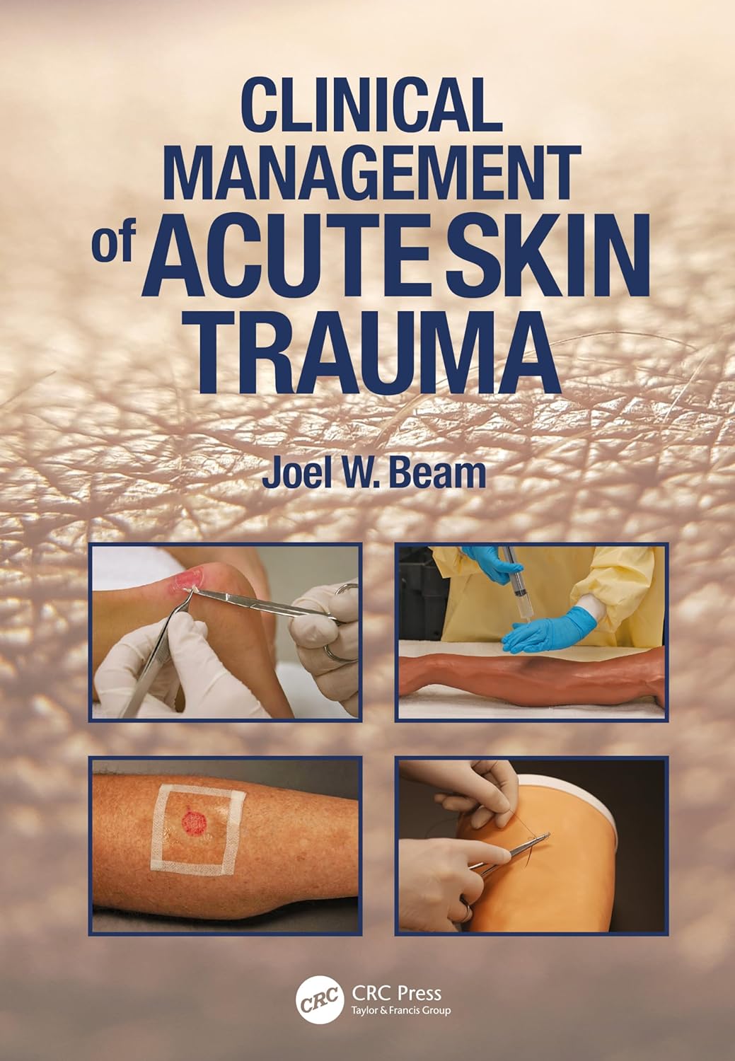 Clinical Management Of Acute Skin Trauma 1st Edition Joel W Beam