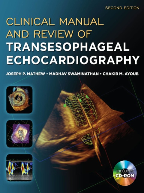 Clinical Manual And Review Of Transesophageal Echocardiography 2e Dec 28 2010 2nd Edition Joseph Mathew