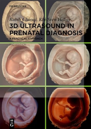 3d Ultrasound In Prenatal Diagnosis A Practical Approach 2nd Edition 2nd Rabih Chaoui