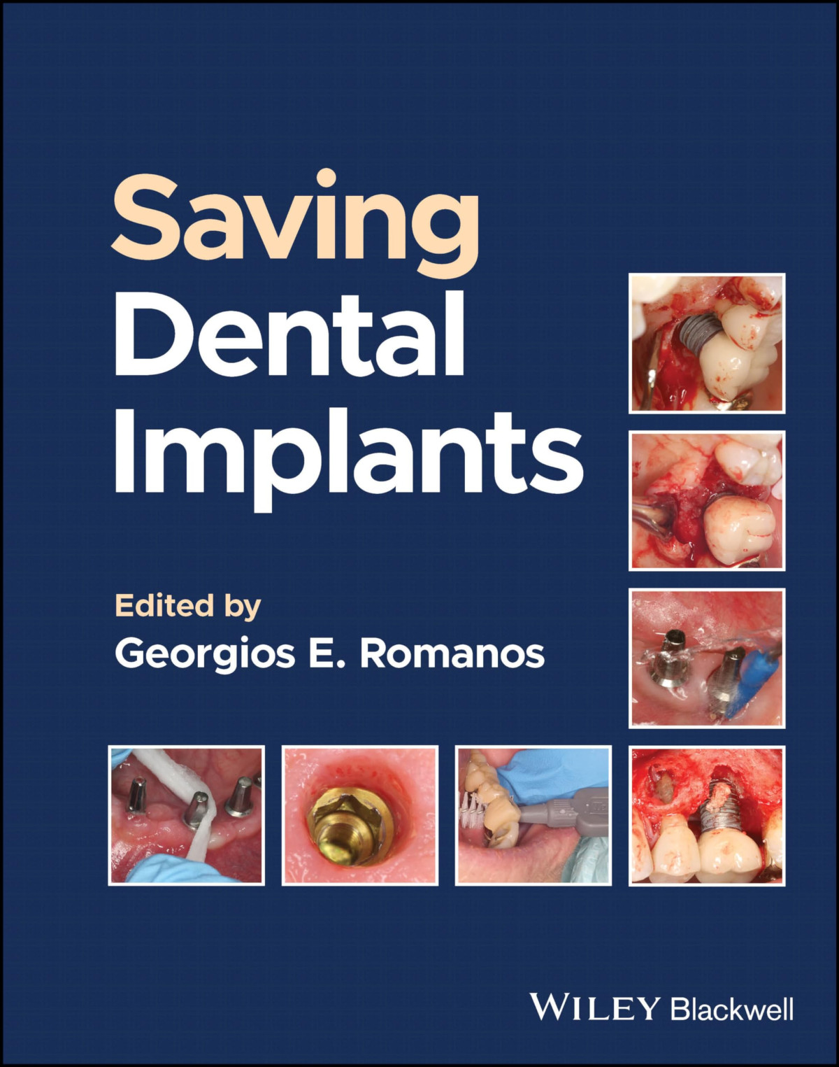 Saving Dental Implants 1st Edition Georgios E Romanos