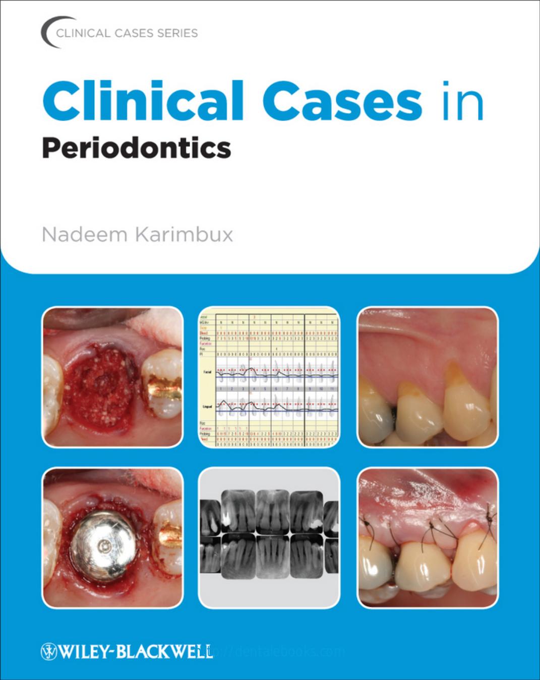 Clinical Cases In Periodontics Karimbux Nadeem