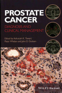 Prostate Cancer Diagnosis And Clinical Management Mar 3 20141118347358wileyblackwell 1st Edition Peter Whelan