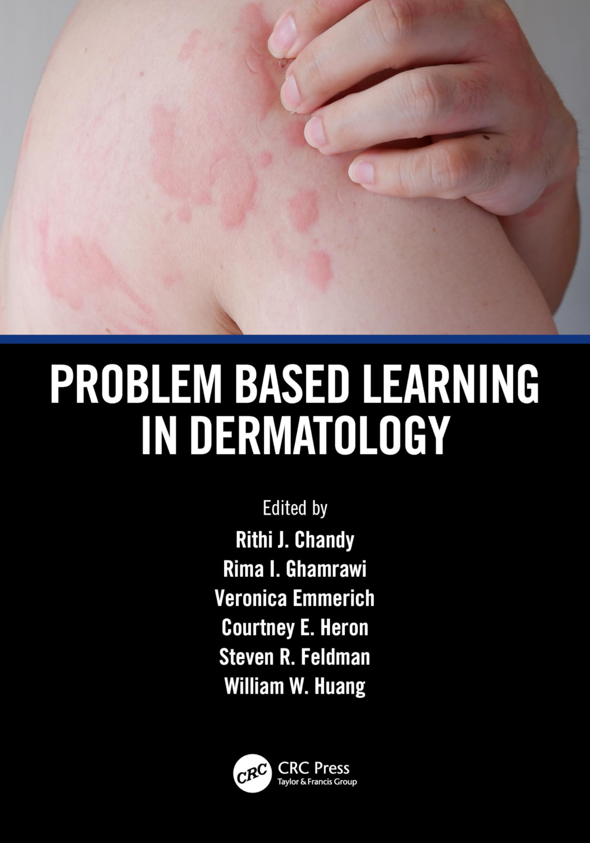 Problem Based Learning In Dermatology 1st Edition Rithi J Chandy