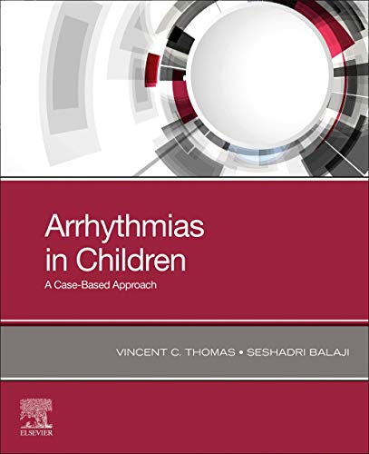 Arrhythmias In Children Vincent C Thomas Md Mha Balaji Seshadri
