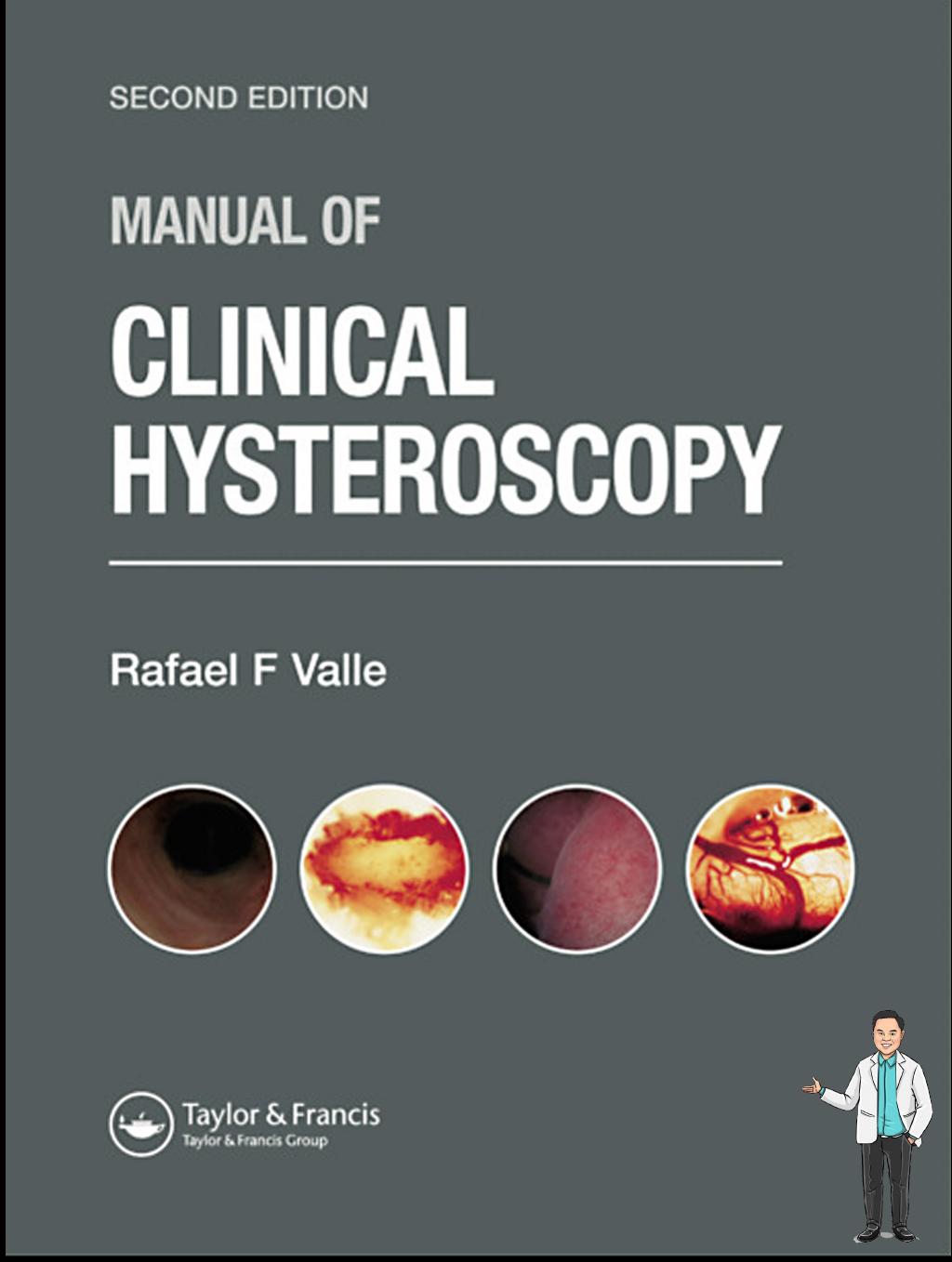 Manual Of Clinical Hysteroscopy Second Edition 2nd Edition Rafael F Valle