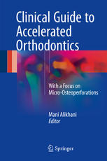 Clinical Guide To Accelerated Orthodontics With A Focus On Microosteoperforations 1st Edition Mani Alikhani Eds