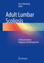 Adult Lumbar Scoliosis A Clinical Guide To Diagnosis And Management 1st Edition Eric O Klineberg