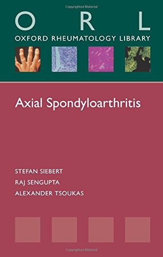 Axial Spondyloarthritis 1st Edition Sengupta Raj Siebert Stefan Tsoukas