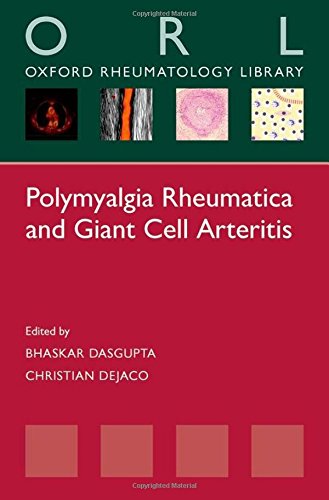 Polymyalgia Rheumatica And Giant Cell Arteritis 1st Edition Dasgupta