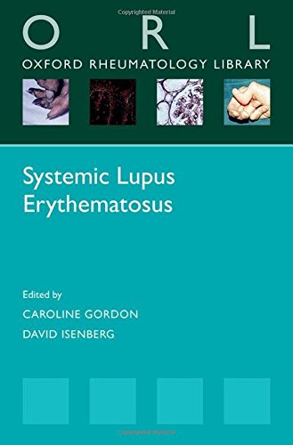 Systemic Lupus Erythematosus 1 Reprint Gordon Caroline Isenberg