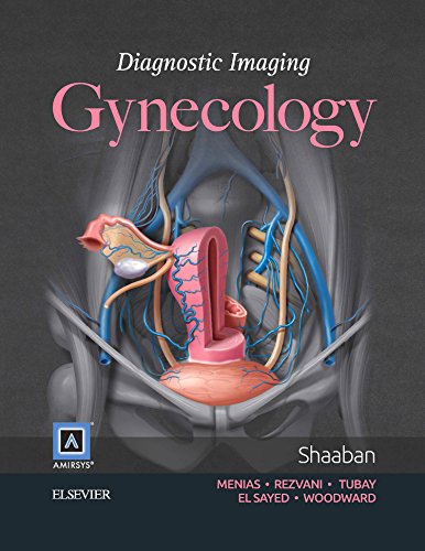 Diagnostic Imaging Gynecology 2nd Edition Akram M Shaaban Et Al