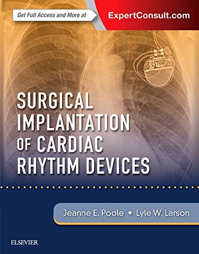 Surgical Implantation Of Cardiac Rhythm Devices 1st Edition Jeanne Poole