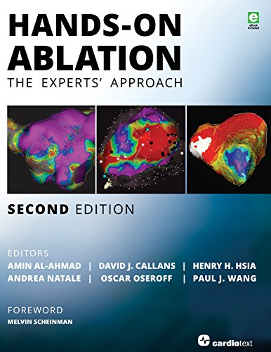 Handson Ablation The Experts Approach 2nd Amin Alahmad