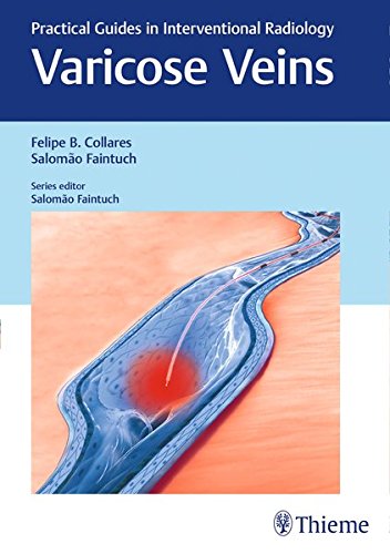 Varicose Veins 1st Edition Felipe B Collares Salomo Faintuch