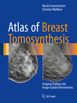 Atlas Of Breast Tomosynthesis Imaging Findings And Imageguided Interventions 1st Edition Martin Sonnenschein