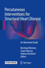 Percutaneous Interventions For Structural Heart Disease An Illustrated Guide 1st Edition Bernhard Reimers