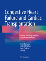 Congestive Heart Failure And Cardiac Transplantation Clinical Pathology Imaging And Molecular Profiles 1st Edition Daniel J Garry