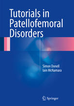 Tutorials In Patellofemoral Disorders 1st Edition Simon Donell