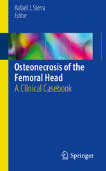 Osteonecrosis Of The Femoral Head A Clinical Casebook 1st Edition Rafael J Sierra Eds