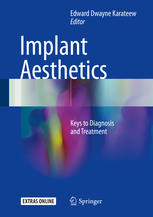 Implant Aesthetics Keys To Diagnosis And Treatment 1st Edition Edward Dwayne Karateew Eds