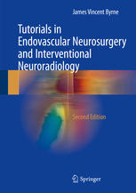 Tutorials In Endovascular Neurosurgery And Interventional Neuroradiology 2nd Edition James Vincent Byrne Auth
