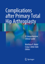 Complications After Primary Total Hip Arthroplasty A Comprehensive Clinical Guide 1st Edition Matthew P Abdel