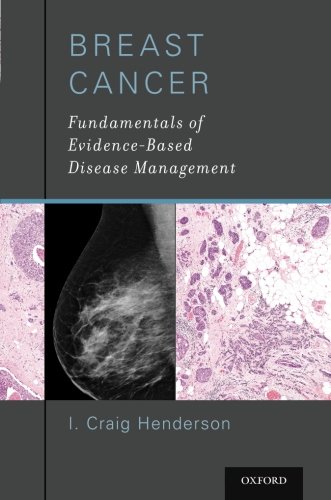 Breast Cancer Fundamentals Of Evidencebased Disease Management 1st Edition Henderson