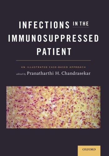 Infections In The Immunosuppressed Patient An Illustrated Casebased Approach 1 Ill Chandrasekar