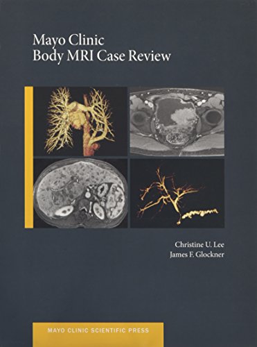 Mayo Clinic Body Mri Case Review 1st Glockner James F Lee Christine U
