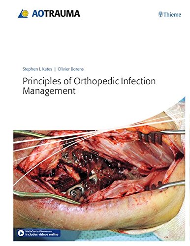 Principles Of Orthopedic Infection Management 1st Edition Stephen Kates