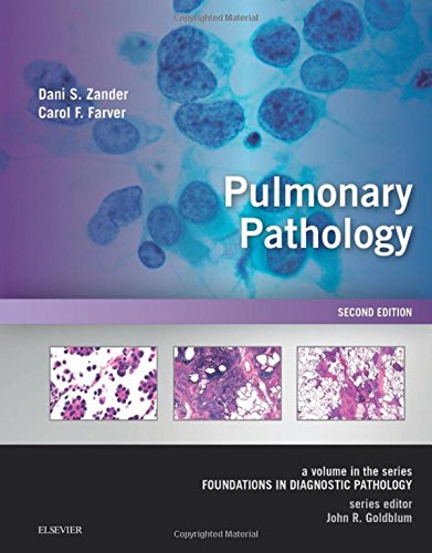 Pulmonary Pathology 2nd Edition Dani S Zander Carol F Farver