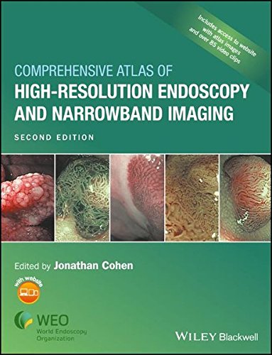 Comprehensive Atlas Of Highresolution Endoscopy And Narrowband Imaging 2nd Edition Jonathan Cohen