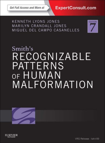 Smiths Recognizable Patterns Of Human Malformation 7th Kenneth Lyons Jones