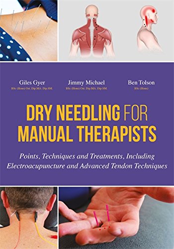 Dry Needling For Manual Therapists Points Techniques And Treatments Including Electroacupuncture And Advanced Tendon Techniques Giles Gyer
