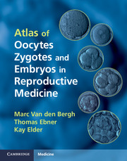 Atlas Of Oocytes Zygotes And Embryos In Reproductive Medicine Marc Van Den Bergh Thomas Ebner Kay Elder