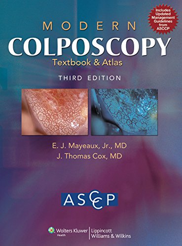 Modern Colposcopy Textbook And Atlas 3rd Ej Mayeaux Jr J Thomas Cox