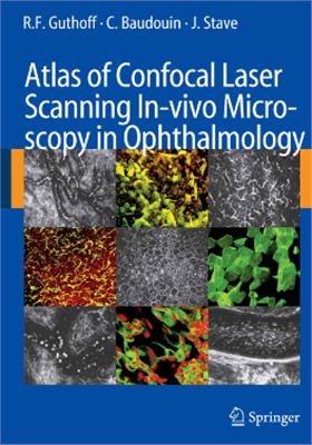 Atlas Of Confocal Laser Scanning Invivo Microscopy In Ophthalmology Guthoff Rf