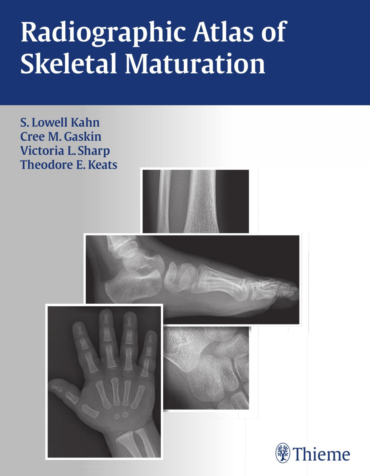 Radiographic Atlas Of Skeletal Maturation 1st Edition S Lowell Kahn