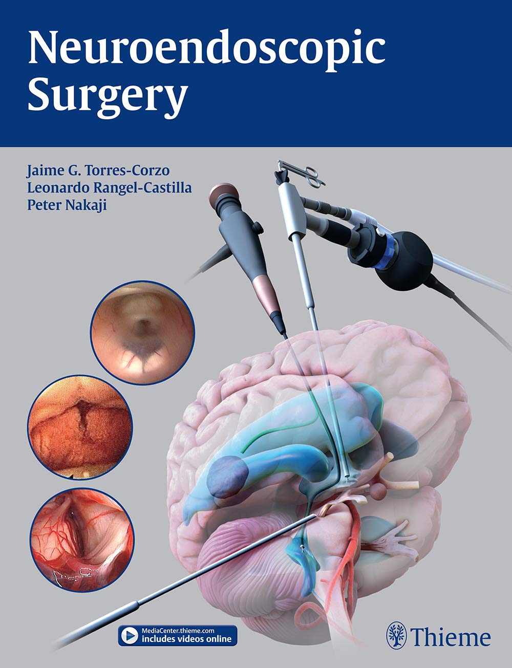 Neuroendoscopic Surgery 1st Edition Jaime Torrescorzo Leonardo Rangelcastilla
