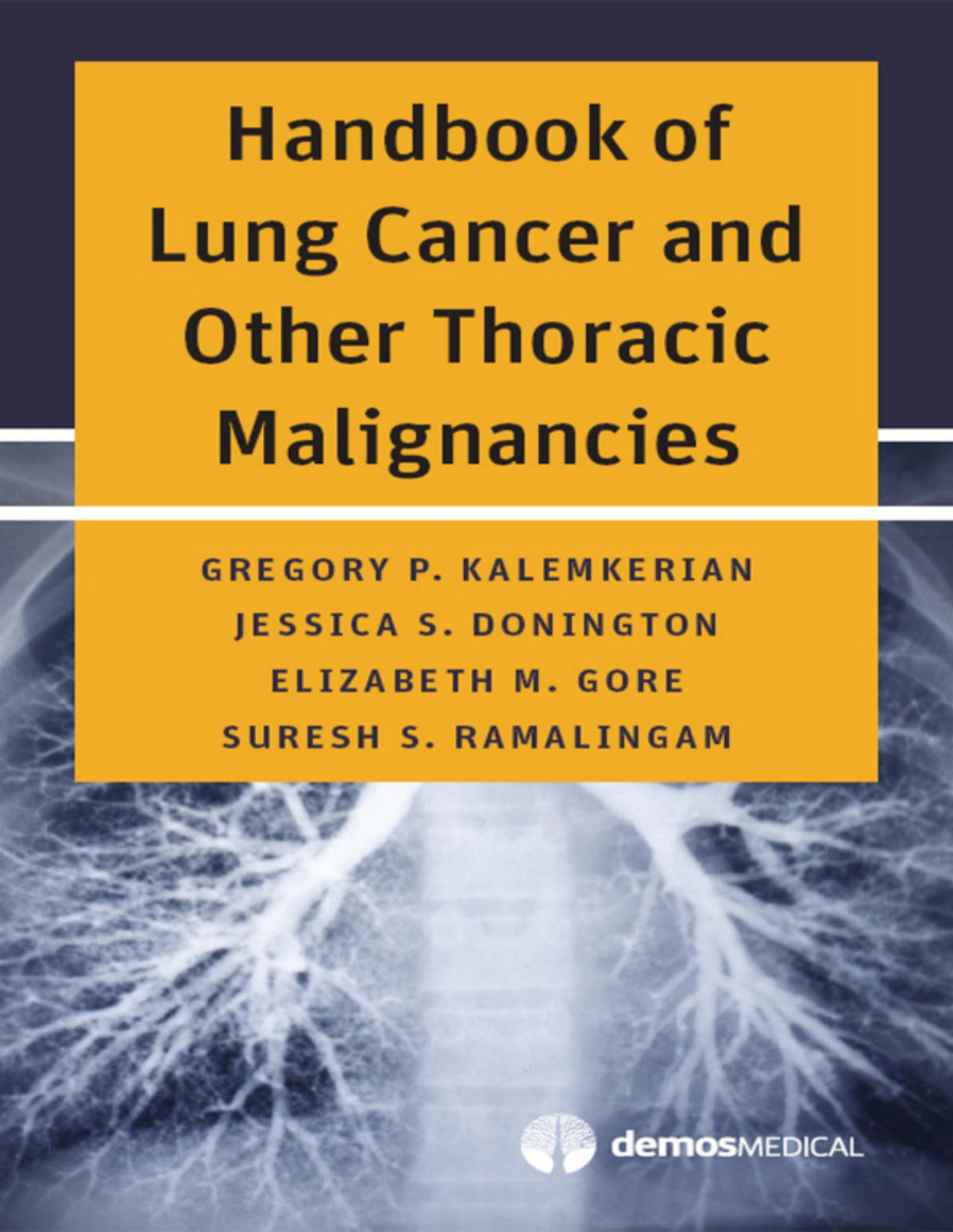 Handbook Of Lung Cancer And Other Thoracic Malignancies 1st Edition Gregory P Kalemkerian