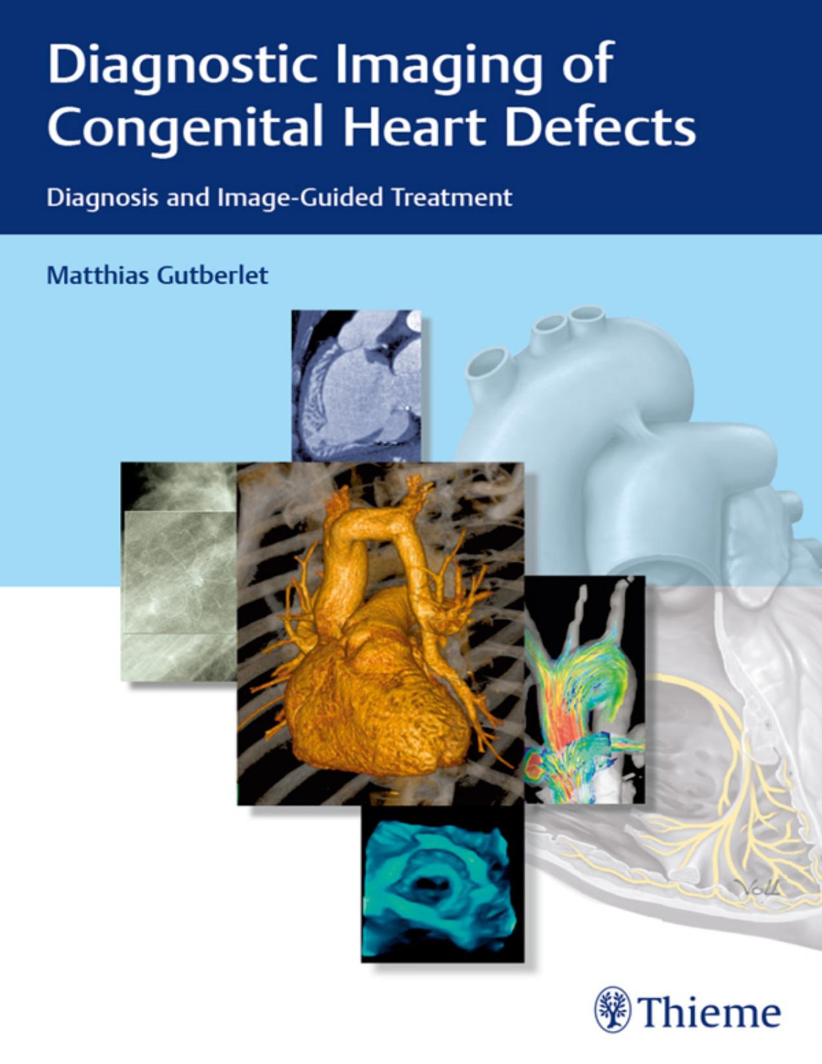 Diagnostic Imaging Of Congenital Heart Defects Diagnosis And Imageguided Treatment Matthias Gutberlet