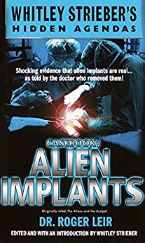 Casebook Alien Implants 1st Edition Leir Roger K