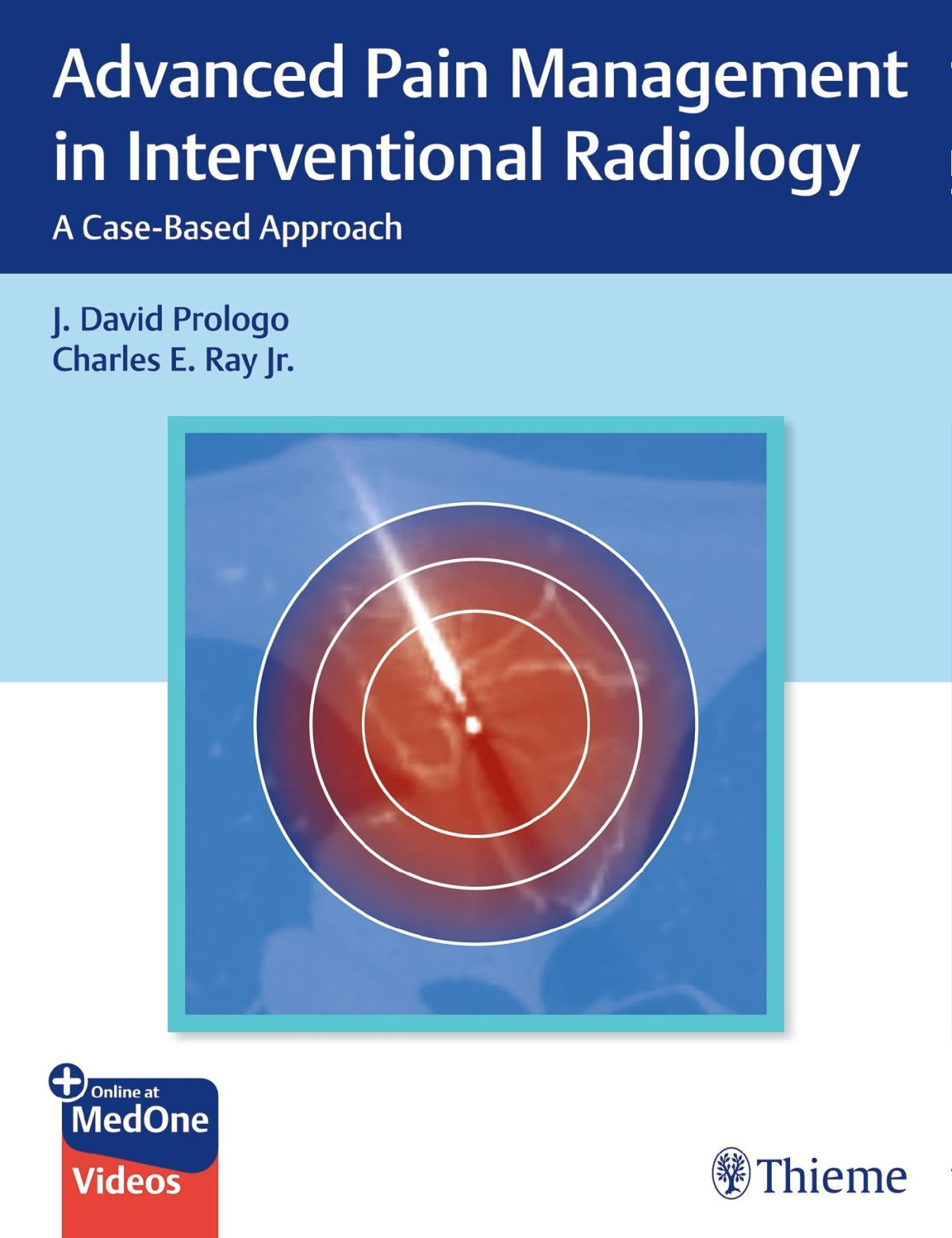 Advanced Pain Management In Interventional Radiology A Casebased Approach 1st Edition Prologo