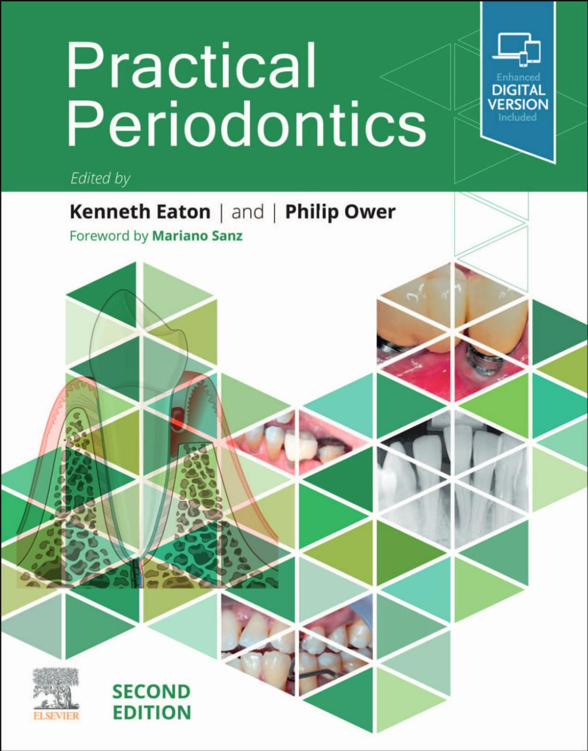 Practical Periodontics Kenneth A Eaton Philip Ower 2nd Edition 2022 312 Pp Isbn 9780323878456 Kenneth A Eaton