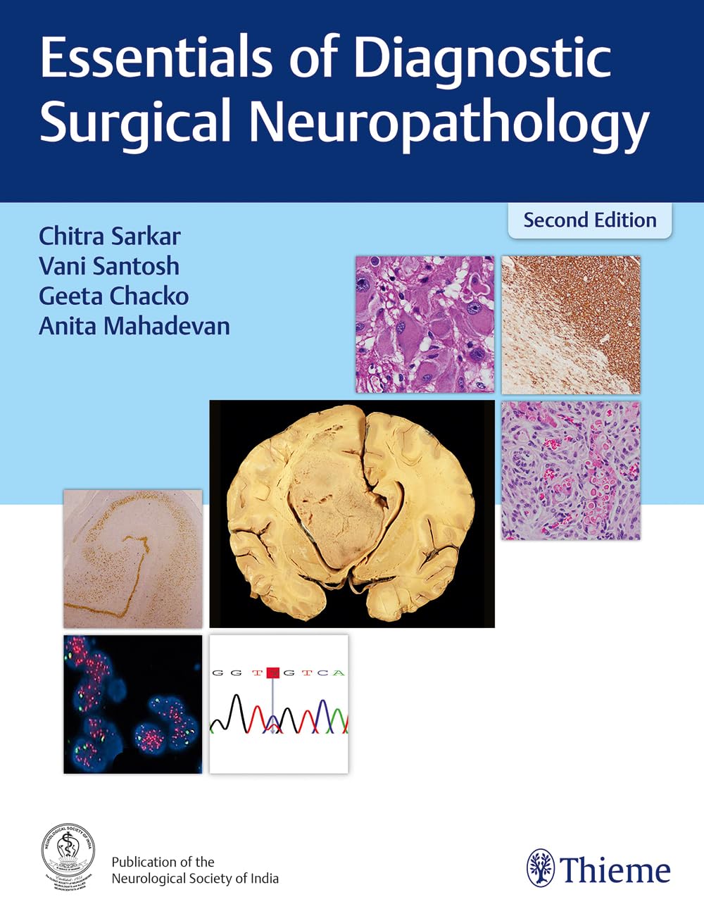 Essentials Of Diagnostic Surgical Neuropathology 2nd Edition Sarkar C Et Al