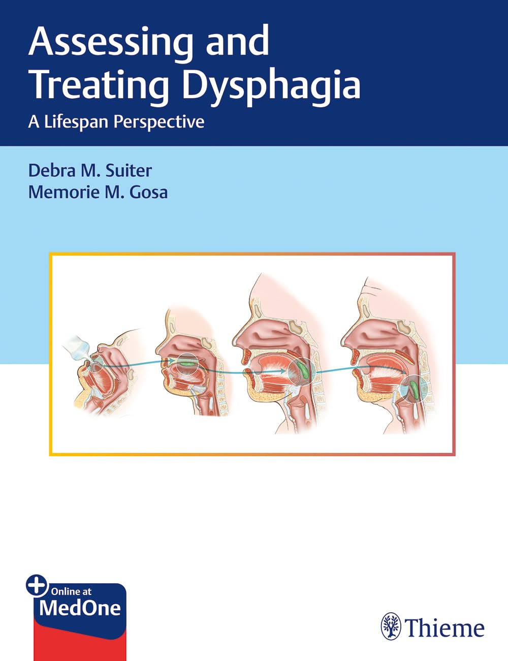 Assessing And Treating Dysphagia A Lifespan Perspective Oct 14 20191626232148thieme 1st Edition Debra M Suiter